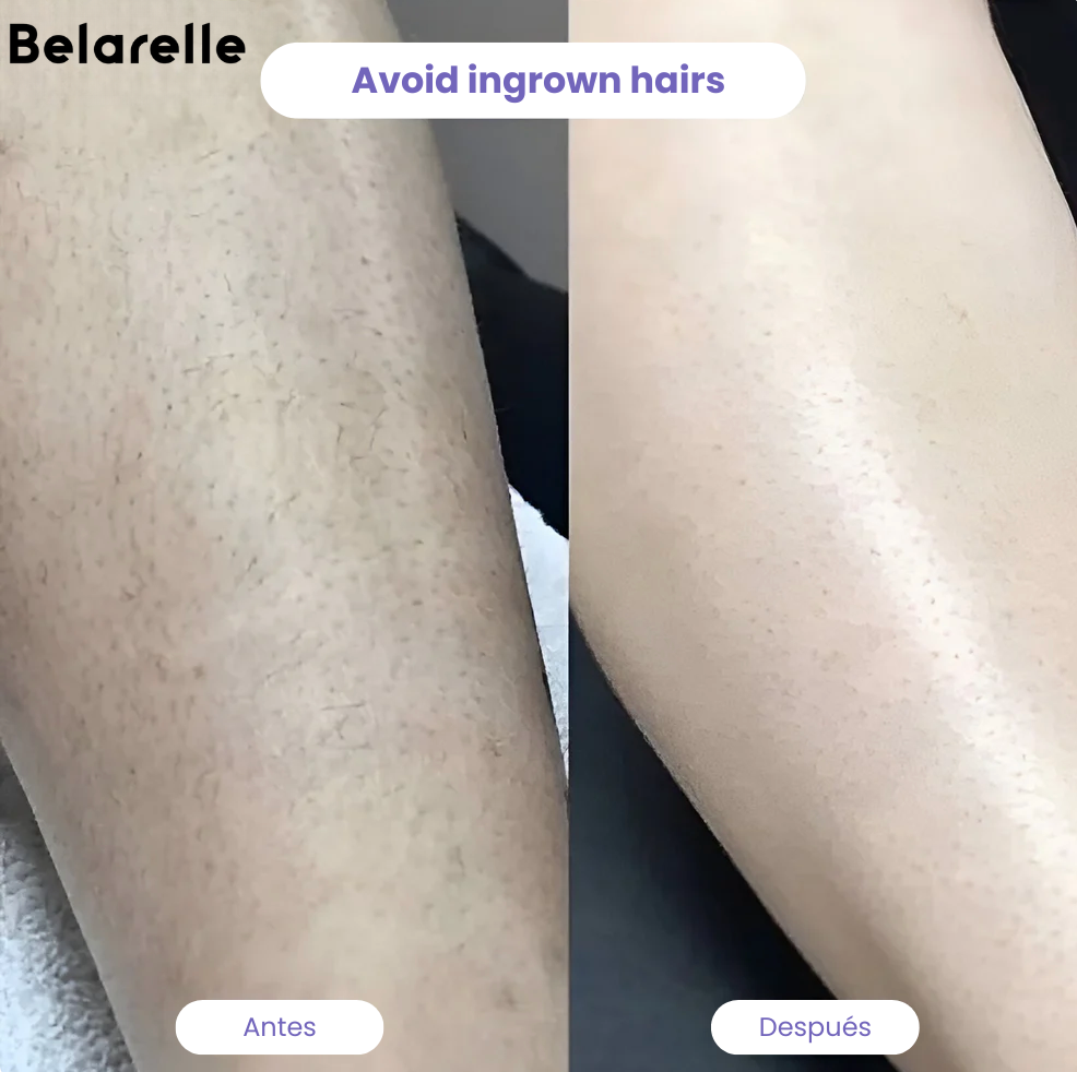 Belarelle™ Afeitadora eléctrica 3 en 1 para mujer