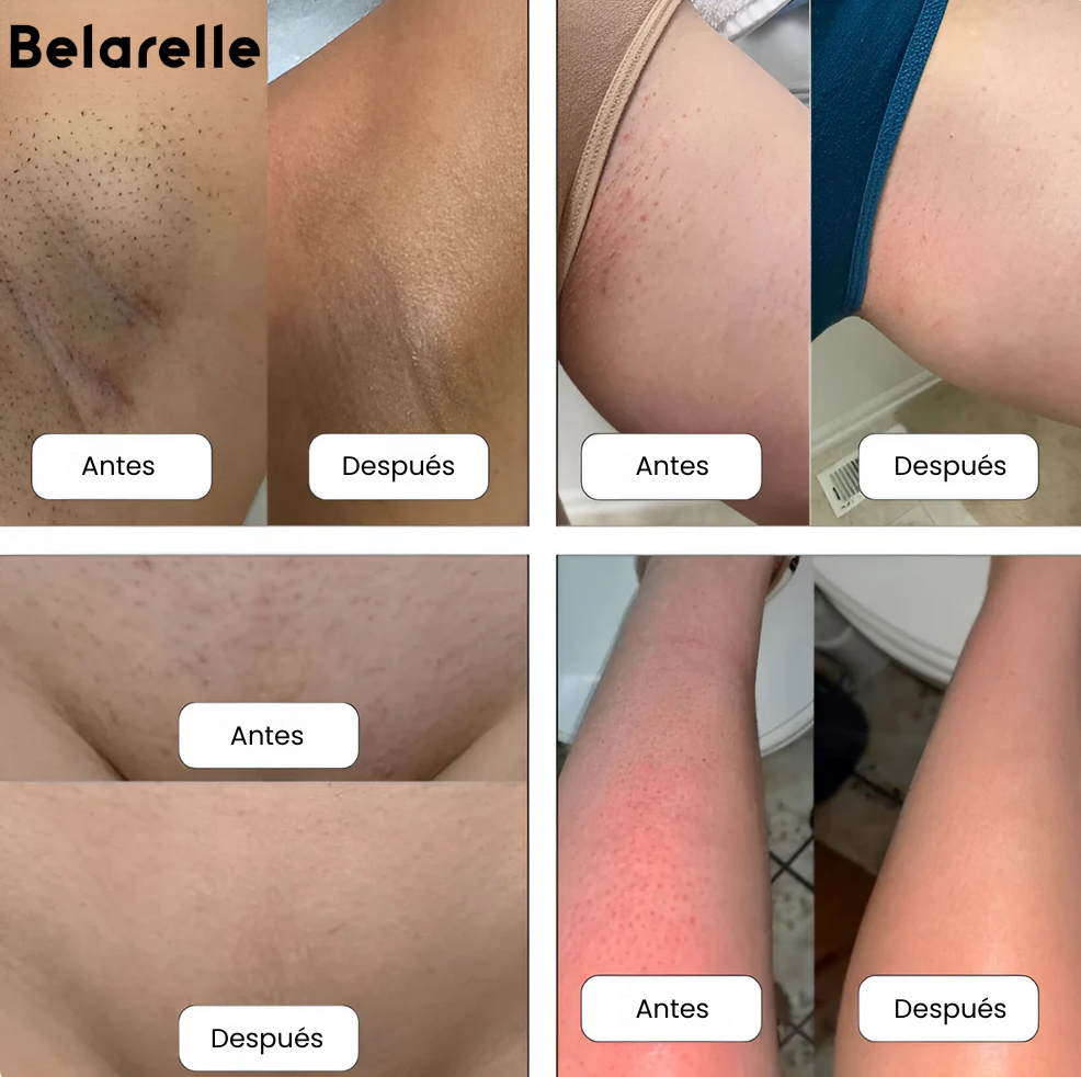 Belarelle™ Afeitadora eléctrica 3 en 1 para mujer